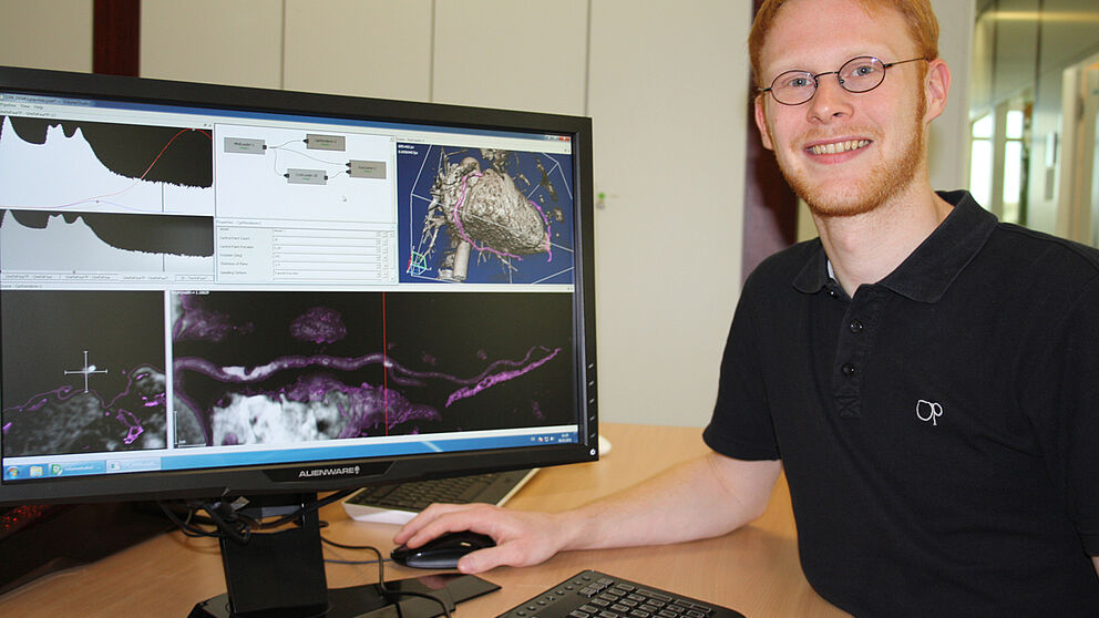 Foto (Universität Paderborn, Katharina Bätz): Stephan Arens vor einer Grafik, die die schnelle Erkennung von Ablagerungen in den Koronargefäßen möglich macht.